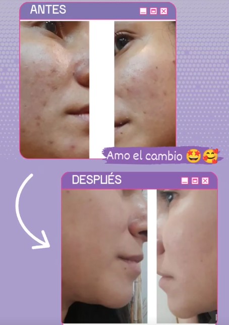 Imagen #1 de Ana maria